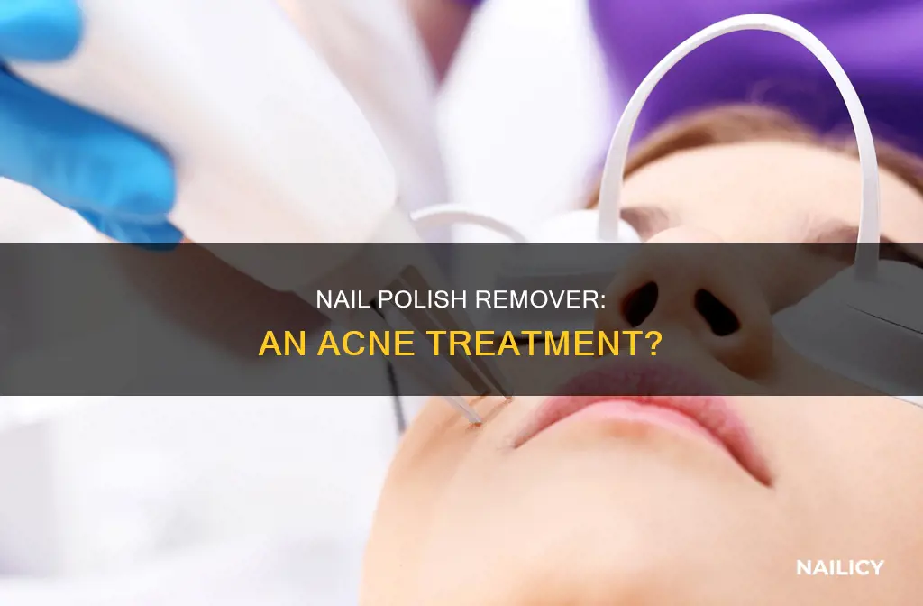 can nail polish remover removes acne
