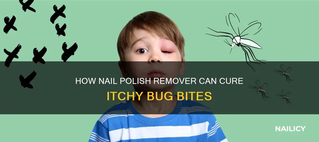 can nail polish remover stop bug bites from itching