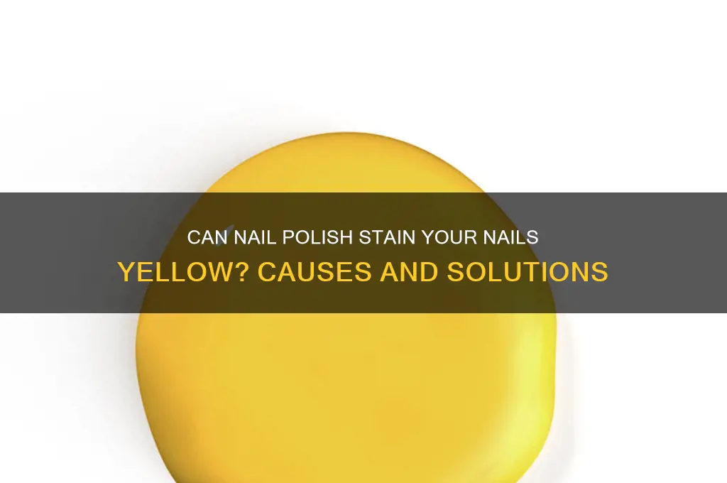 can nail polish stain your nails yellow