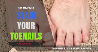 Can Nail Polish Stain Toenails? Tips to Prevent Yellowing