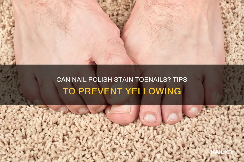 can nail polish stain your toenails