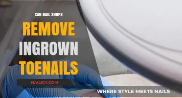 Toenail Troubles: Ingrown Nails and the Nail Shop Solution
