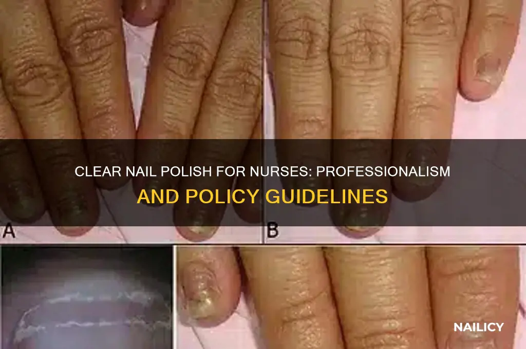 can nurses wear clear nail polish