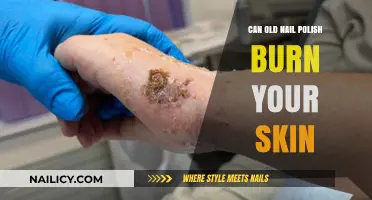 Can Old Nail Polish Cause Skin Burns? Safety Tips Revealed