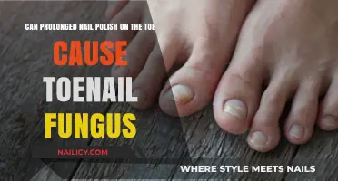 Prolonged Nail Polish Use: A Risk for Toenail Fungus?