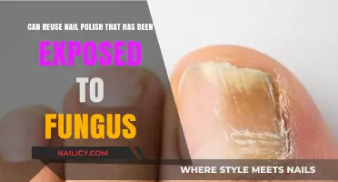 Can You Safely Reuse Fungus-Exposed Nail Polish? Expert Advice