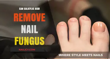 Salicylic Acid for Nail Fungus: Effective Treatment?
