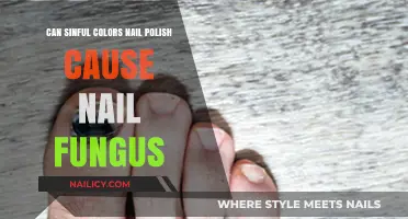 Can Sinful Colors Nail Polish Lead to Nail Fungus?