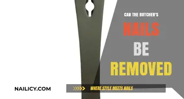 Butcher's Nails: Can They Be Removed?