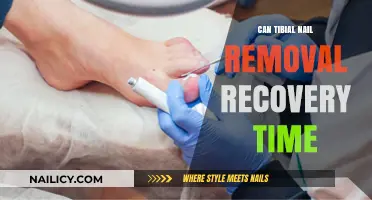 Speedy Recovery After Tibial Nail Removal: What to Expect