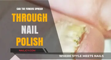 Can Toe Fungus Spread Through Nail Polish? Facts and Prevention Tips