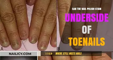 Does Toenail Polish Stain the Underside of Toenails? Find Out Here