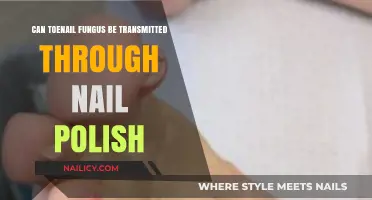 Can Toenail Fungus Spread via Shared Nail Polish? Facts Revealed