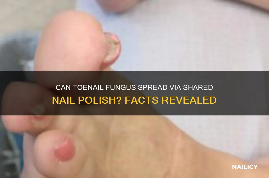 can toenail fungus be transmitted through nail polish