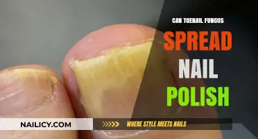 Toenail Fungus and Nail Polish: Can It Spread or Prevent Infection?