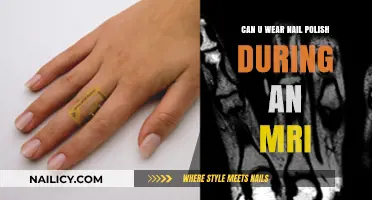 Can You Wear Nail Polish During an MRI? Safety Tips