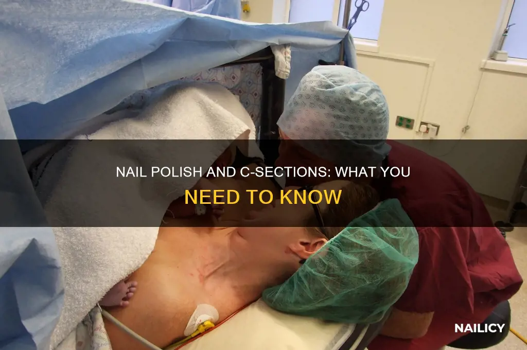 can u wear nail polish during c section
