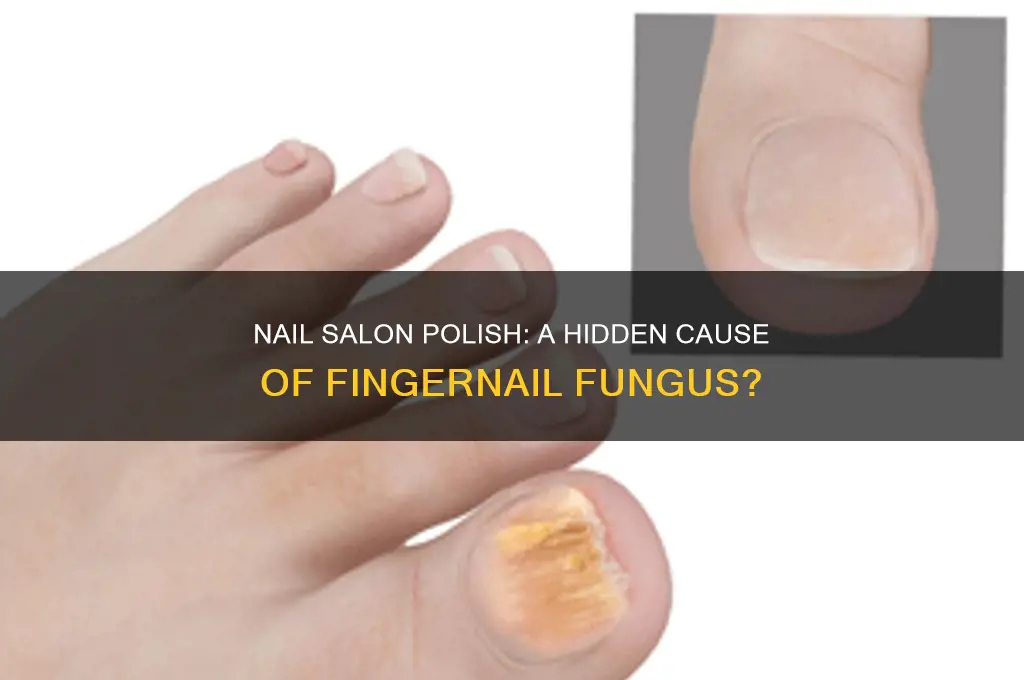 can using nail salon polish cause fingernsil fungus