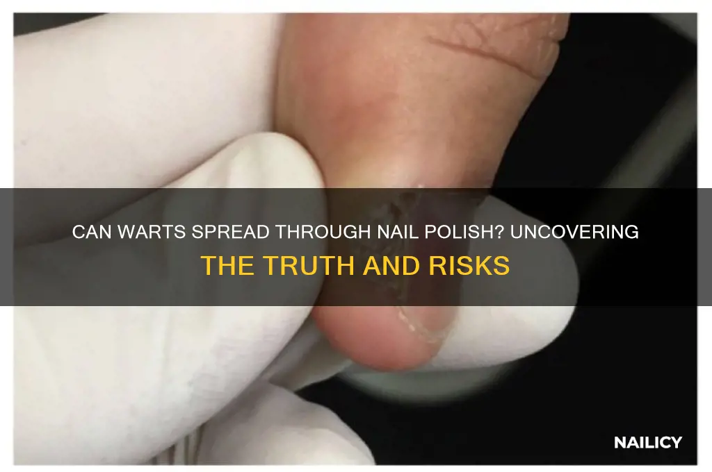 can warts spread through nail polish