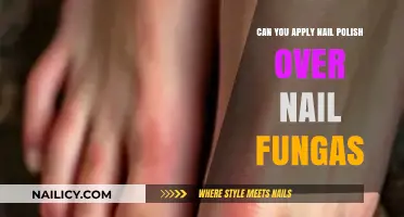 Nail Polish Over Fungus: Safe Practice or Risky Cover-Up?