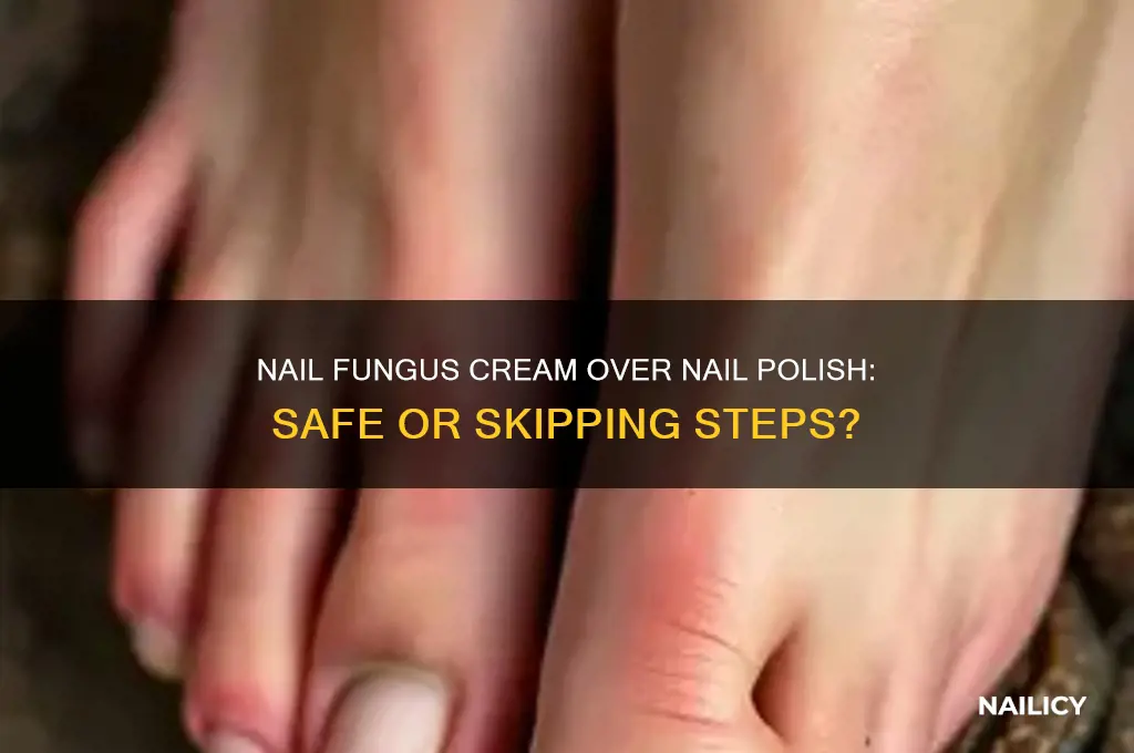 can you apply nailfungus cream over nail polish