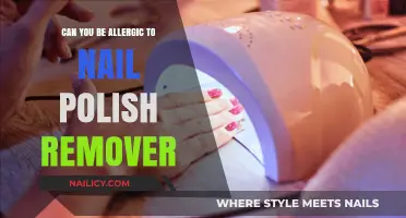 Nail Polish Remover: Allergies and What to Do About Them
