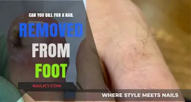 Billing for Foot Care: Nail Removal