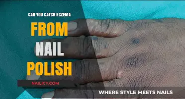 Can Nail Polish Trigger Eczema? Unraveling the Skin-Care Myth