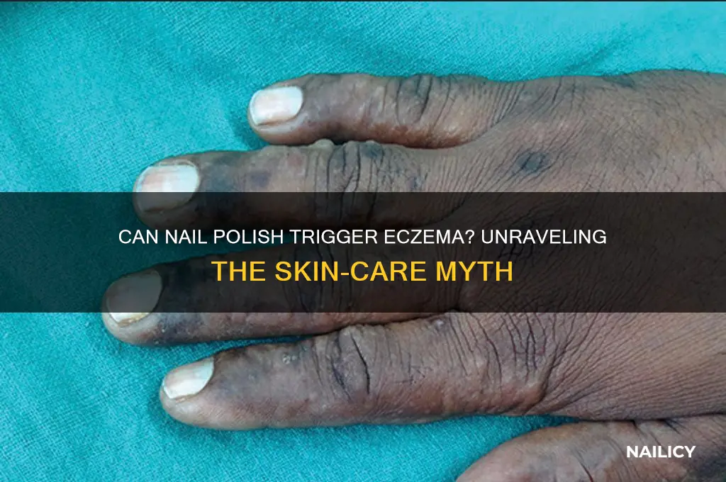 can you catch eczema from nail polish