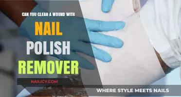 Cleaning Wounds: Is Nail Polish Remover Safe?