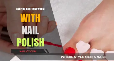 Can Nail Polish Cure Ringworm? Separating Myth from Reality