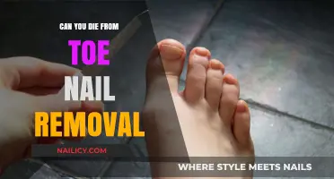 Toe Nail Removal: Is it Life-Threatening?