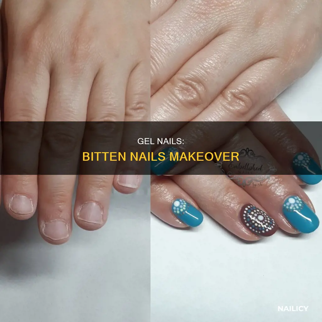 can you do gel nails on bitten nails