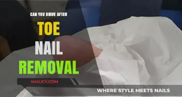 Toe Nail Removal: Is Driving Safe?