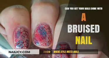 Nail Care Quandary: Can You Get Your Nails Done with a Bruised Nail?