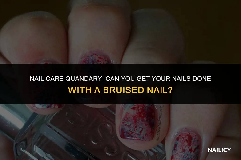 can you get your nails done with a bruised nail