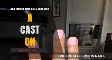 Nail Care with a Cast: Tips and Tricks for a Fabulous Manicure