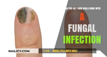 Nail Care Quandary: Manicures and Fungal Infections Explained