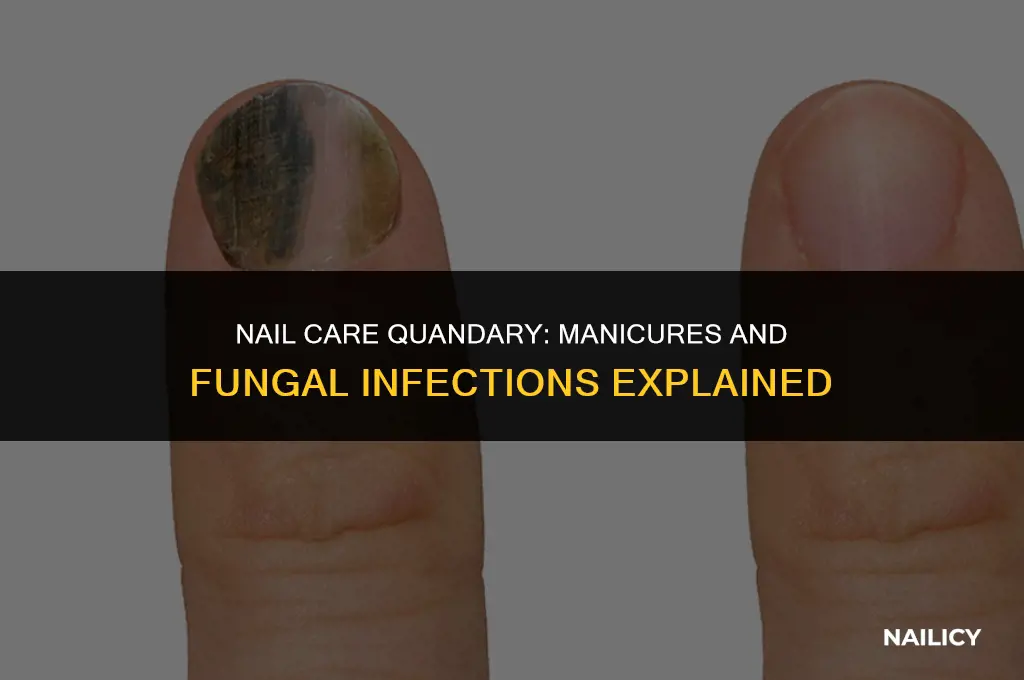can you get your nails done with a fungal infection