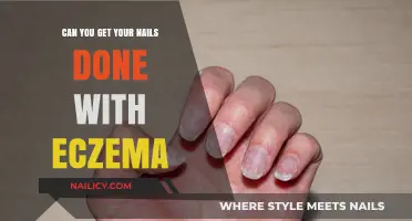 Nail Care and Eczema: What You Need to Know