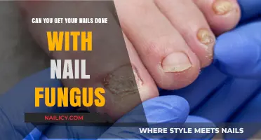 Nail Care Quandary: Manicures and Nail Fungus - What You Need to Know
