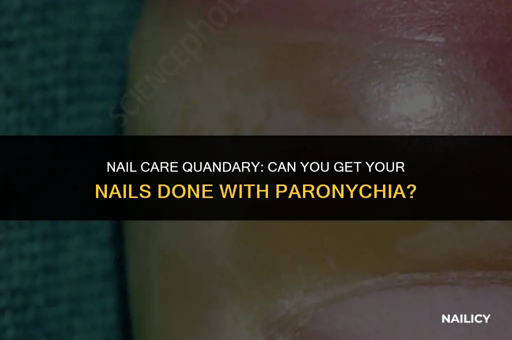 can you get your nails done with paronychia