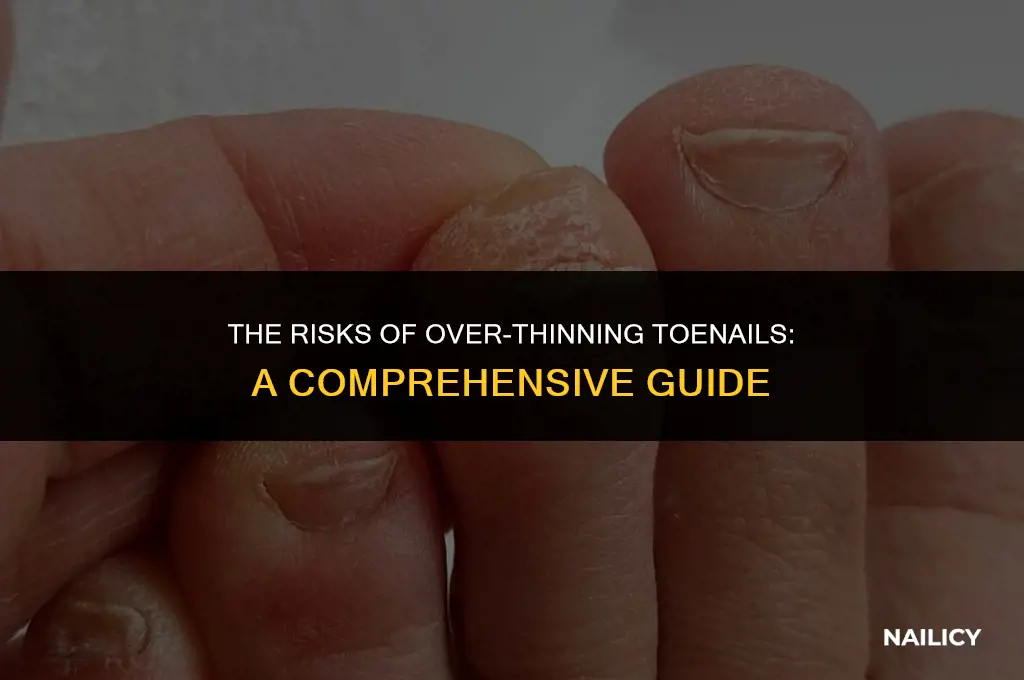 can you get your toe nail too thin