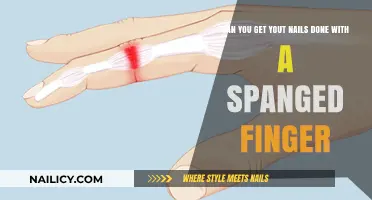 Nail Care Quandary: Manicures with a Sprained Finger?
