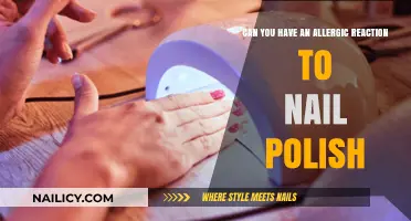 Can Nail Polish Cause Allergic Reactions? Symptoms and Solutions