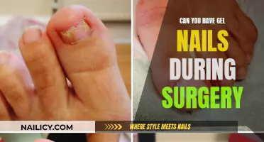 Gel Nails and Surgery: What You Need to Know