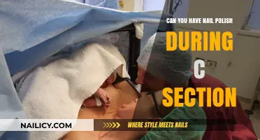 Nail Polish During C-Section: What You Need to Know