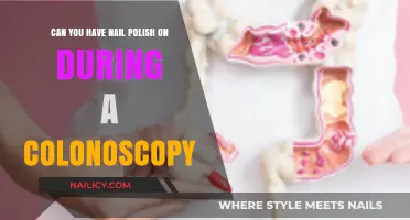 Nail Polish and Colonoscopy Prep: What You Need to Know