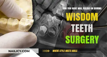 Wisdom Teeth Surgery and Nail Polish: What You Need to Know