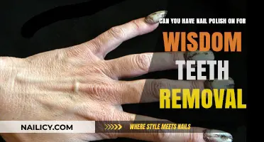Wisdom Teeth Removal: Nail Polish Don'ts